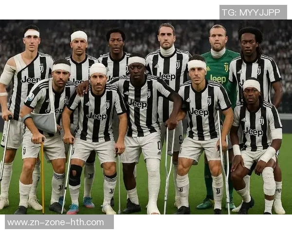 拉齐奥确认塔瓦雷斯左腿肌肉受伤将缺席对尤文联赛较量